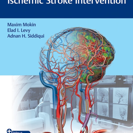 Video Atlas of Acute Ischemic Stroke Intervention