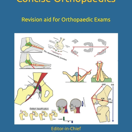 Concise Orthopaedic Notes: Revision aid for FRCS, EBOT , SICOT and Board Examinations