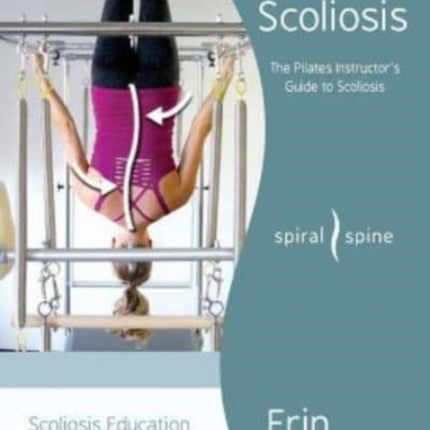 Analyzing Scoliosis: The Pilates Instructor's Guide to Scoliosis