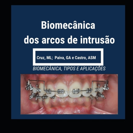 Biomecânica dos Arcos de Intrusão
