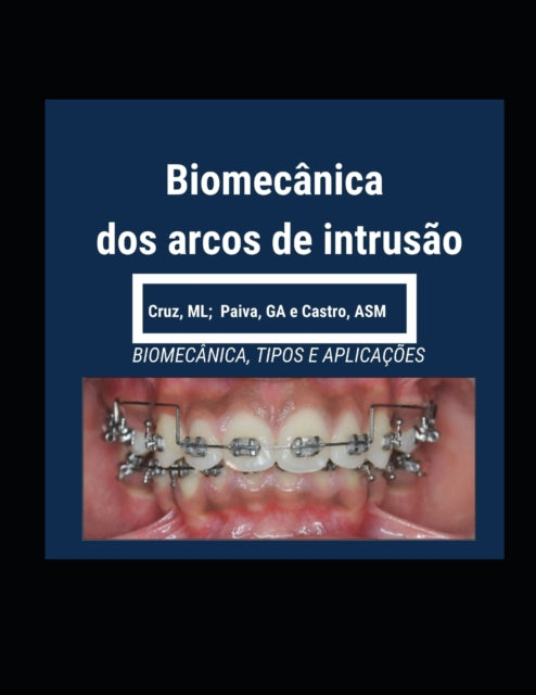 Biomecânica dos Arcos de Intrusão