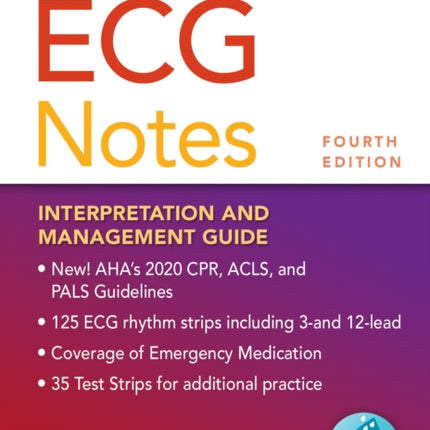 ECG Notes: Interpretation and Management Guide