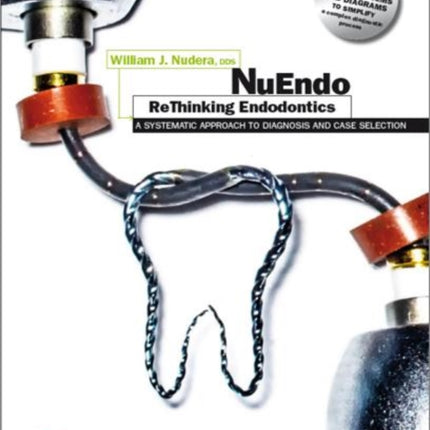 NuEndo ReThinking Endodontics - A systematic approach to diagnosis and case selection