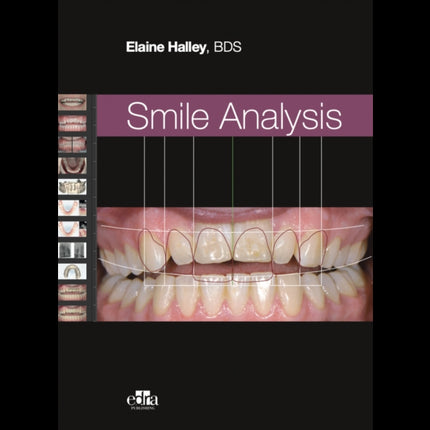 Smile Analysis