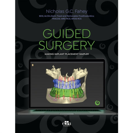 Guided Surgery