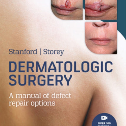 Dermatologic Surgery