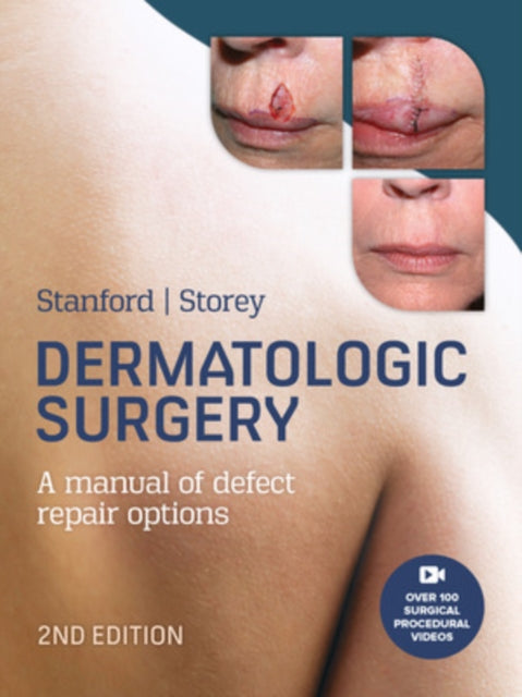 Dermatologic Surgery