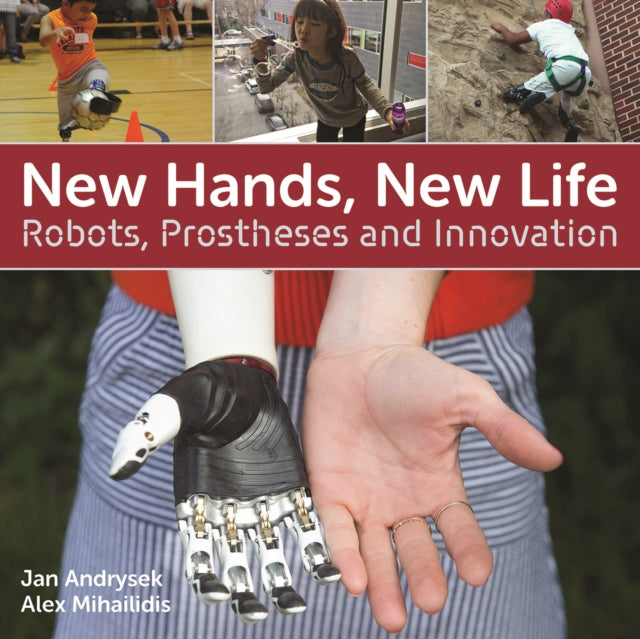 New Hands, New Life: Robots, Prostheses and Innovation