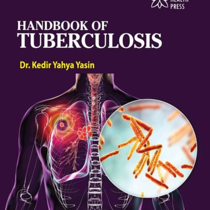 Handbook of Tuberculosis