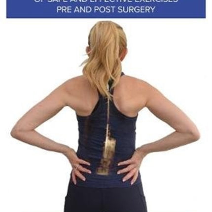 The Scoliosis Handbook of Safe and Effective Exercises Pre and Post Surgery