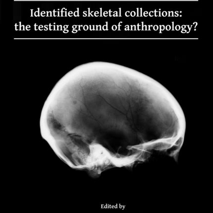 Identified skeletal collections: the testing ground of anthropology?