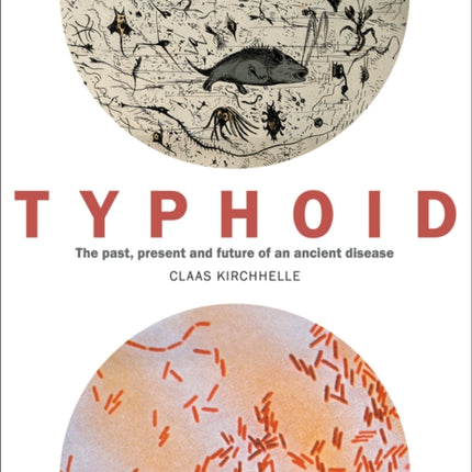 Typhoid: The past, present, and future of an ancient disease