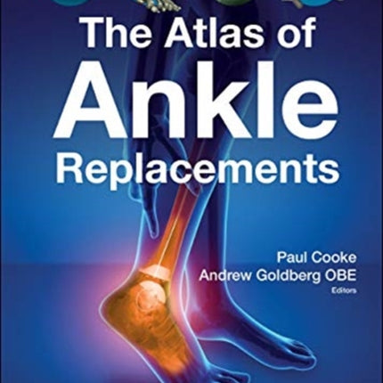 Atlas Of Ankle Replacements, The