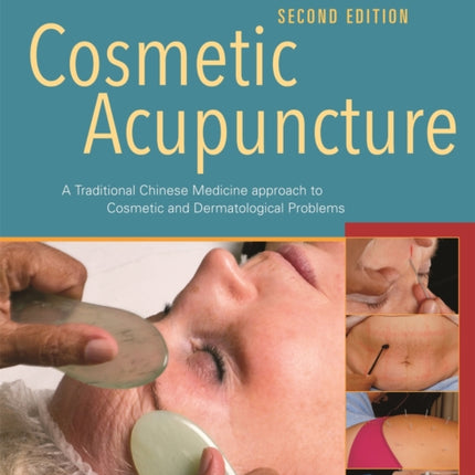 Cosmetic Acupuncture, Second Edition: A Traditional Chinese Medicine Approach to Cosmetic and Dermatological Problems