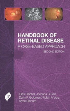 Handbook of Retinal Disease: A Case-Based