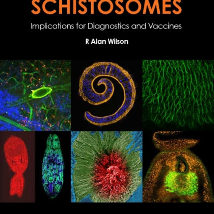 The Cell Biology of Schistosomes  Implications for Diagnostics and Vaccines