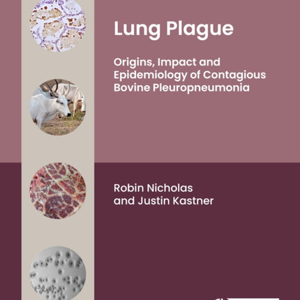 Lung Plague  Origins Impact and Epidemiology of