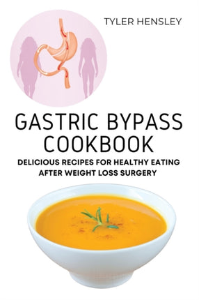 Gastric Bypass Cookbook: Delicious Recipes for Healthy Eating After Weight Loss Surgery