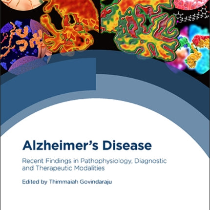 Alzheimer's Disease: Recent Findings in Pathophysiology, Diagnostic and Therapeutic Modalities