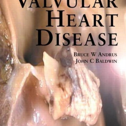 Valvular Heart Disease