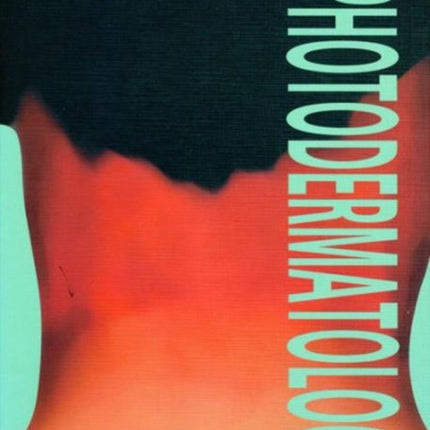 Photodermatology