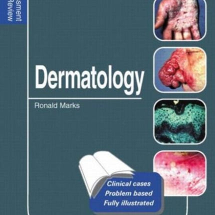 Dermatology: Self-Assessment Colour Review