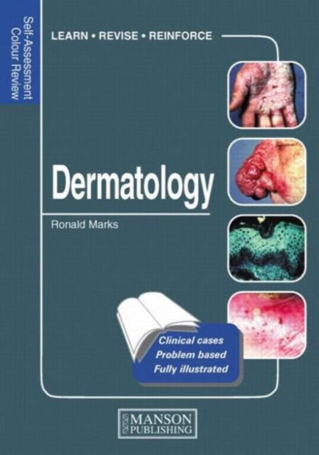 Dermatology: Self-Assessment Colour Review