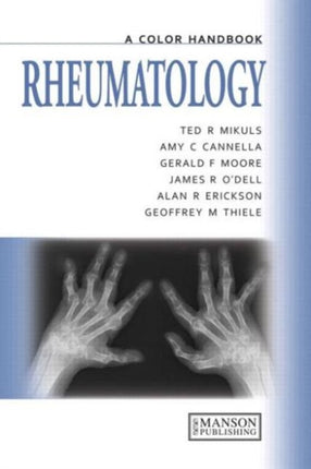 Rheumatology: A Color Handbook