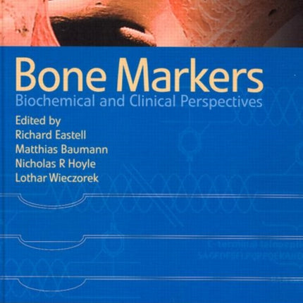 Bone Markers: Biochemical and Clinical Perspectives