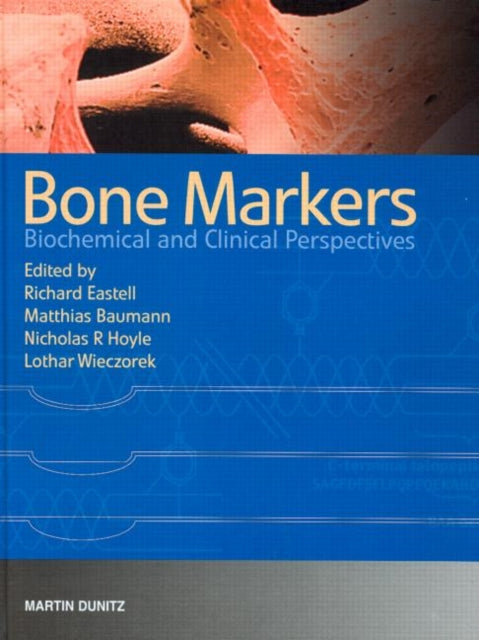 Bone Markers: Biochemical and Clinical Perspectives