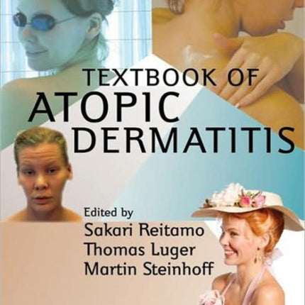 Textbook of Atopic Dermatitis