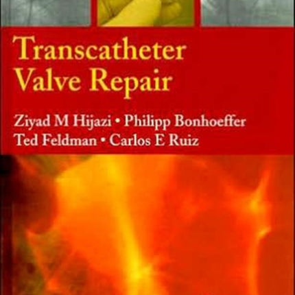 Transcatheter Valve Repair