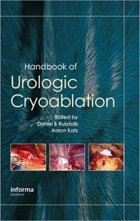 Handbook of Urologic Cryoablation