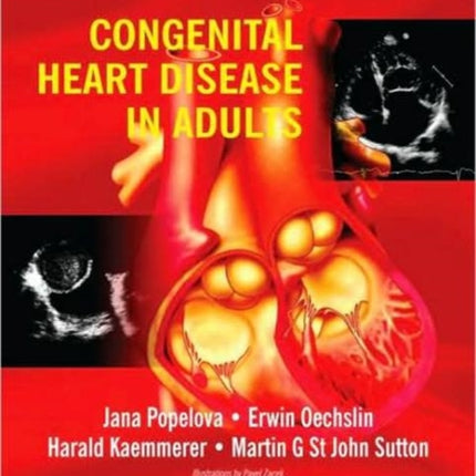 Congenital Heart Disease in Adults