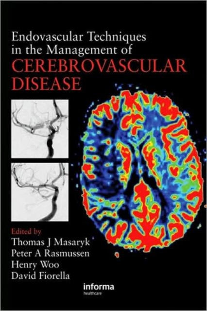 Endovascular Techniques in the Management of Cerebrovascular Disease