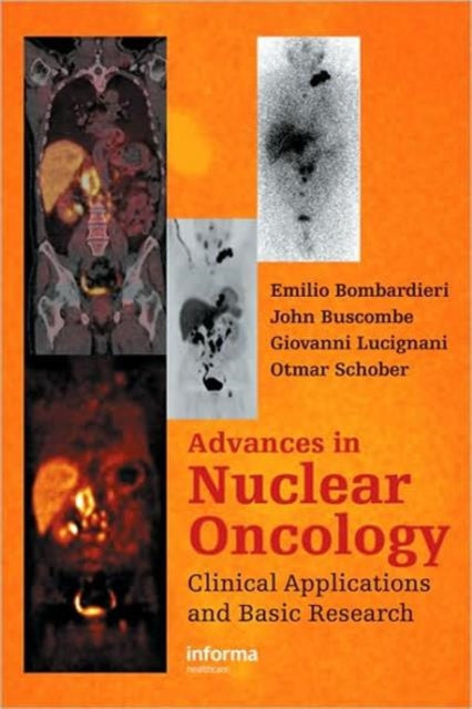 Advances in Nuclear Oncology:: Diagnosis and Therapy