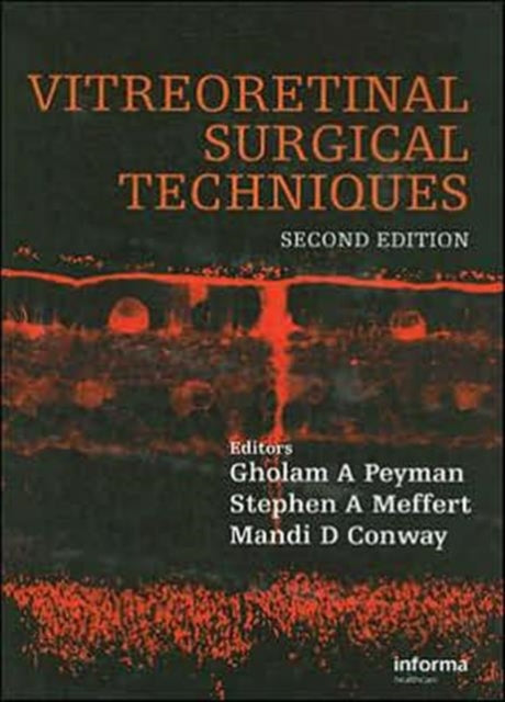 Vitreoretinal Surgical Techniques, Second Edition