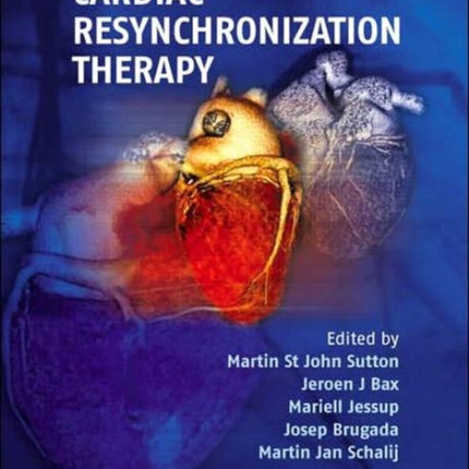 Cardiac Resynchronization Therapy