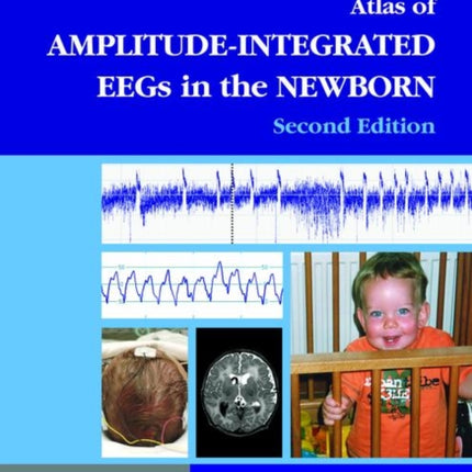 An Atlas of Amplitude-Integrated EEGs in the