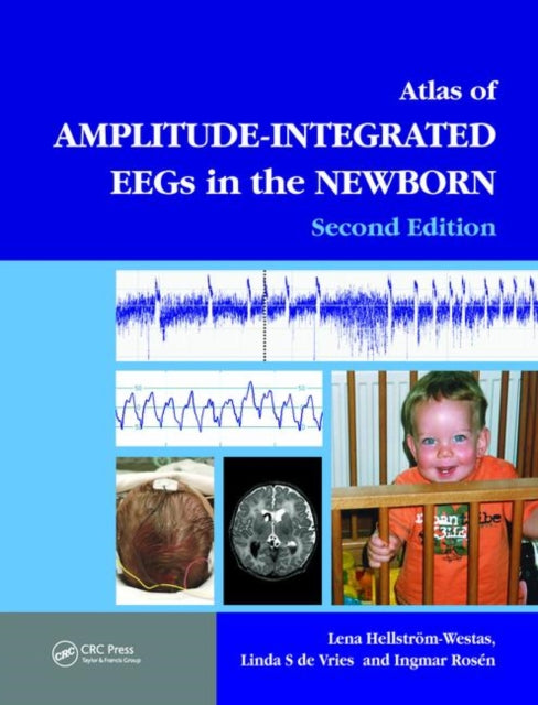 An Atlas of Amplitude-Integrated EEGs in the