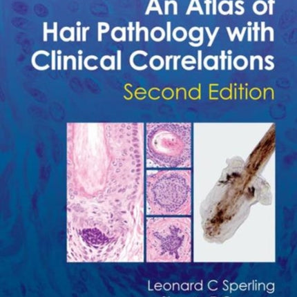 An Atlas of Hair Pathology with Clinical