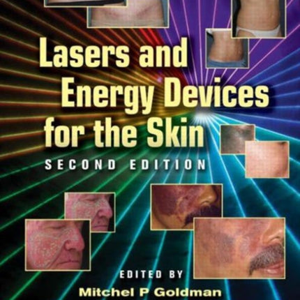 Lasers and Energy Devices for the Skin