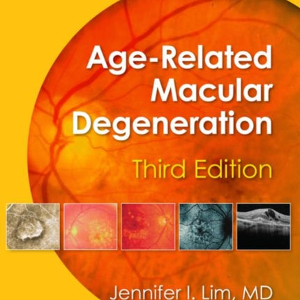 Age-Related Macular Degeneration, Third Edition
