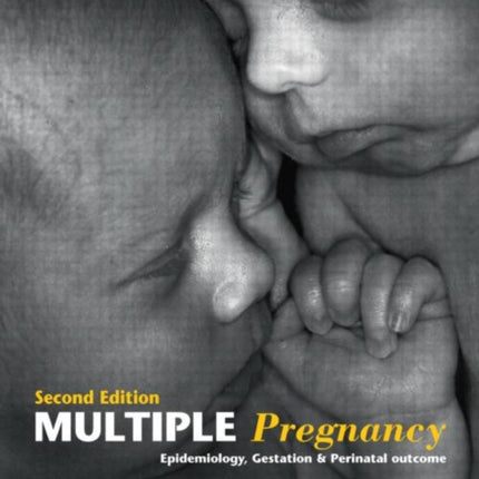 Multiple Pregnancy: Epidemiology, Gestation, and Perinatal Outcome