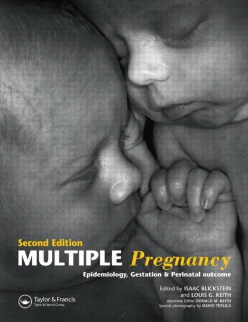 Multiple Pregnancy: Epidemiology, Gestation, and Perinatal Outcome