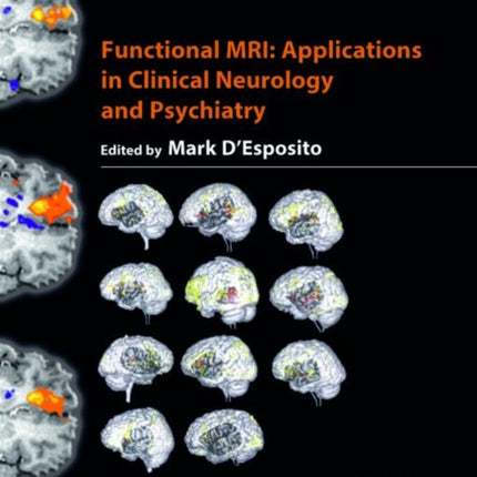 Functional MRI: Applications in Clinical