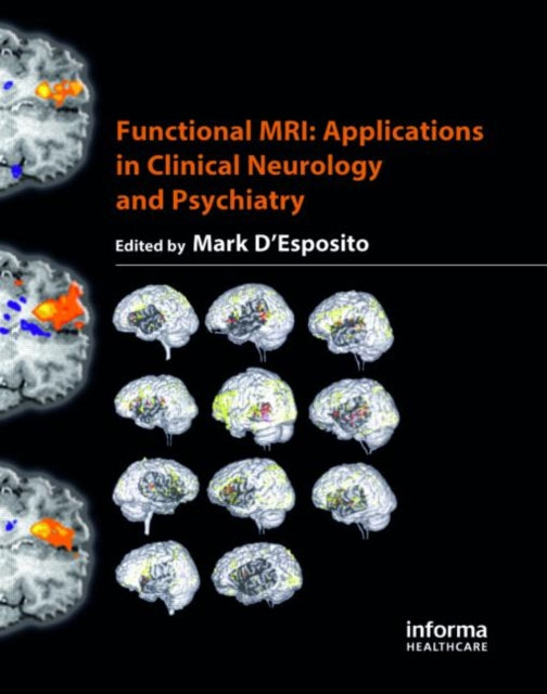 Functional MRI: Applications in Clinical