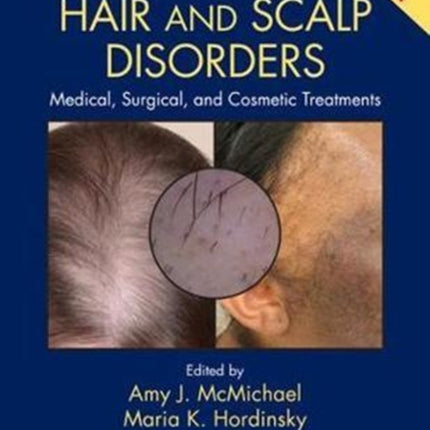 Hair and Scalp Disorders: Medical, Surgical, and Cosmetic Treatments, Second Edition