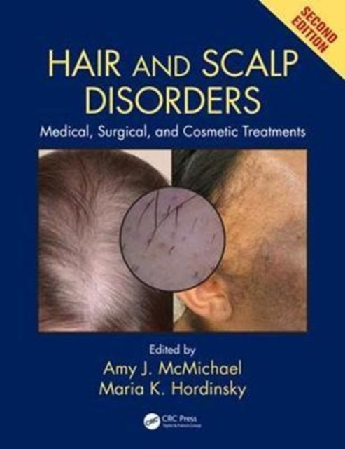 Hair and Scalp Disorders: Medical, Surgical, and Cosmetic Treatments, Second Edition