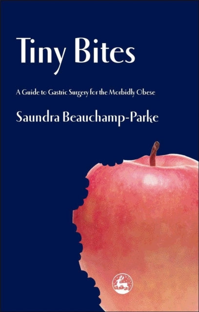 Tiny Bites: A Guide to Gastric Surgery for the